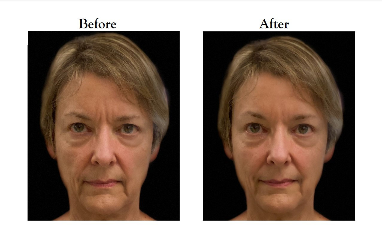 Applications Of Microbial Toxins And Virulence Factors Chavarrialab